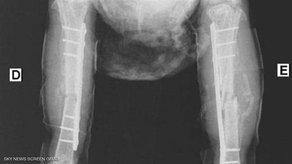 الدجاجة التي أجري