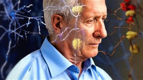 علاج للزهايمر 