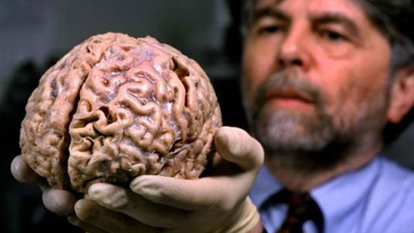 العقل البشرى ارشيف