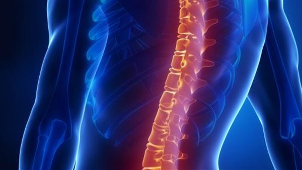 صورة ارشفية