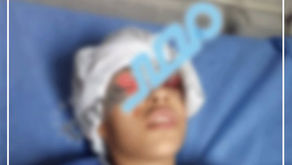 إصابة أحدى الفتيات