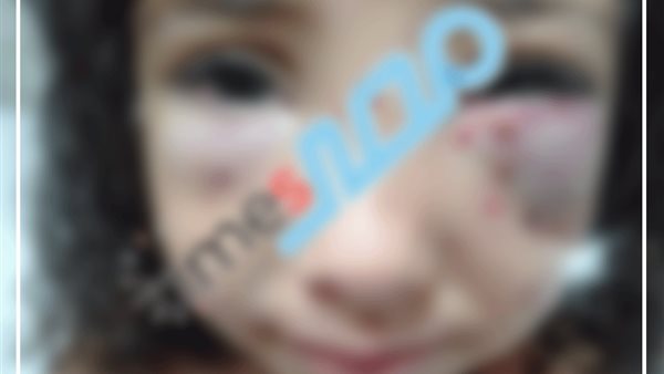 صورة إحدى الضحايا