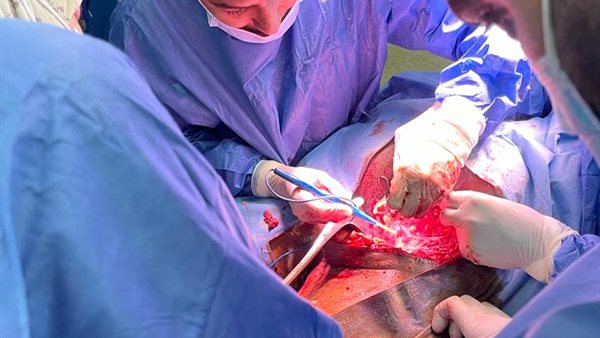 جانب من العملية