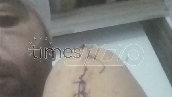 صورة الضحية 