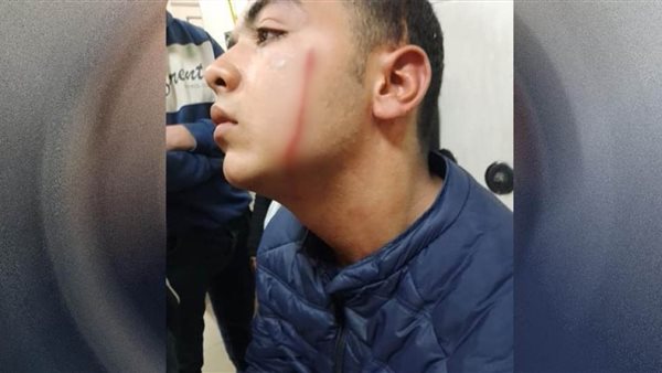 المجني عليه 