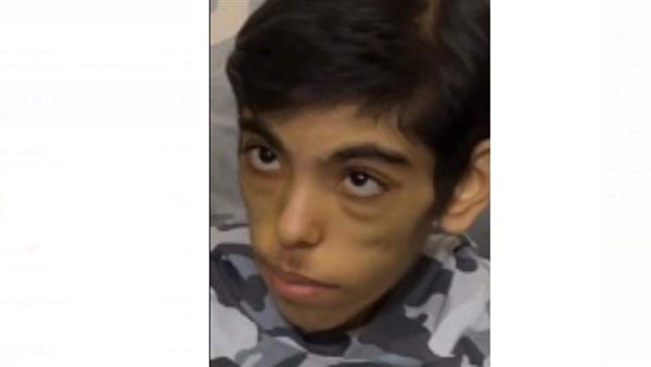 الطفل مصطفى 