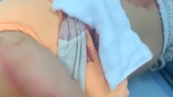 صورة من الحدث