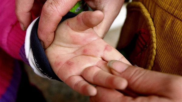 صورة أرشيفية