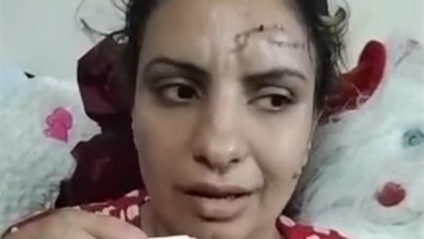 ضحية زوج شقيقتها