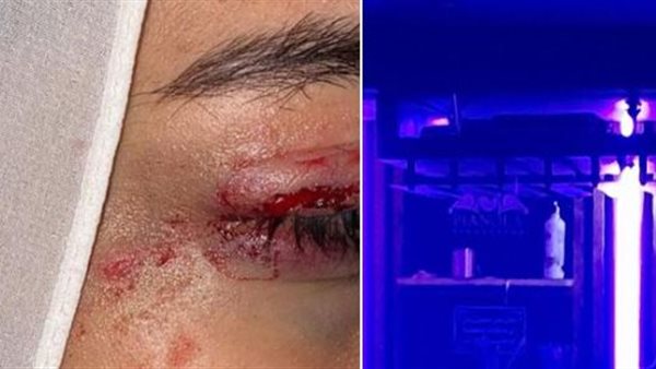 واقعة التحرش