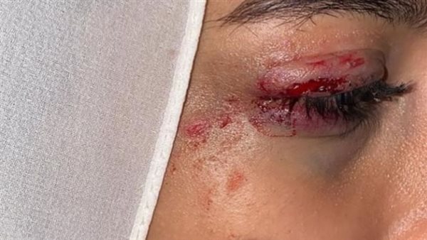 الفتاة ضحية التحرش