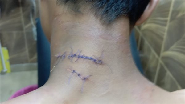 اصابات الطالب 