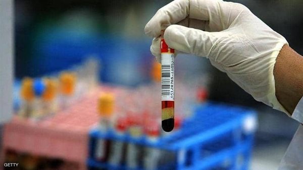 صورة أرشيفية  الاجسام