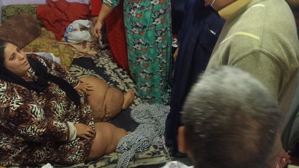 الرئيس يوجه بعلاج