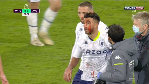 اصابة تريزيجيه