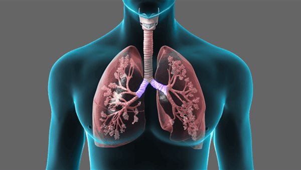 التهاب الرئوى - صورة