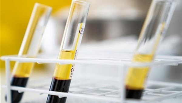 تجميع البلازما- صورة