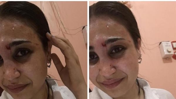 ضحية العنف الأسرى