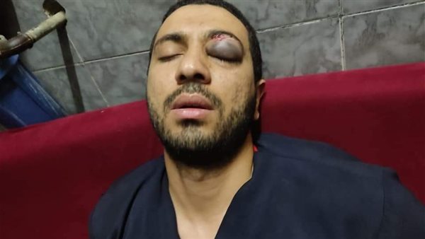 الفنى بعد التعدي