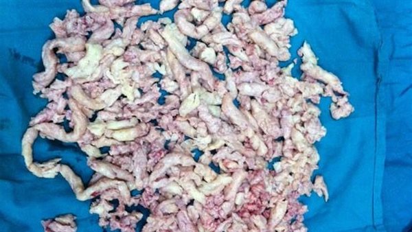 صورة ارشيفية