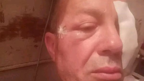 السائق المصاب 