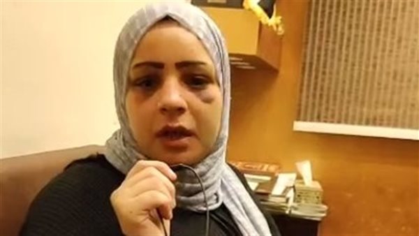 السيدة التي تعرضت