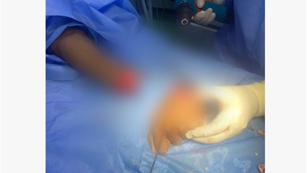 المجني عليه 