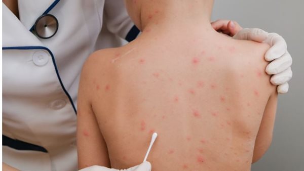 صورة ارشيفية 