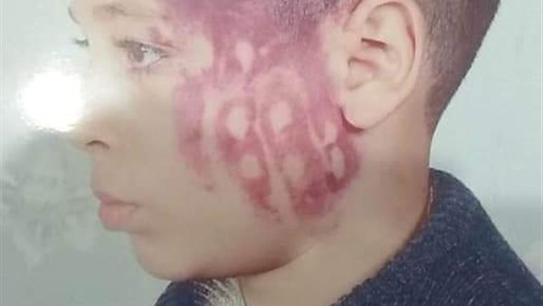 الطالب المعتدى عليه