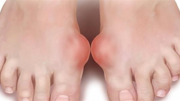 صورة  ارشيفية