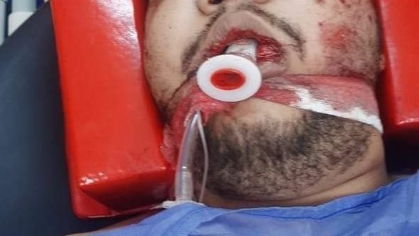 من بينهم مهندس بين