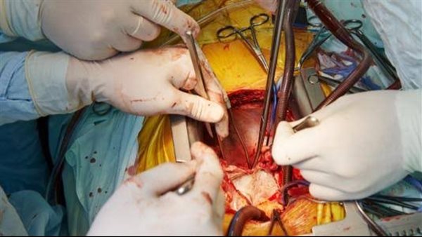 جراحة لشرايين القلب