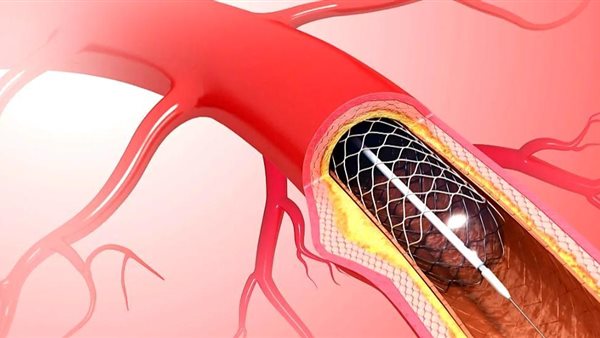 صورة  ارشيفية