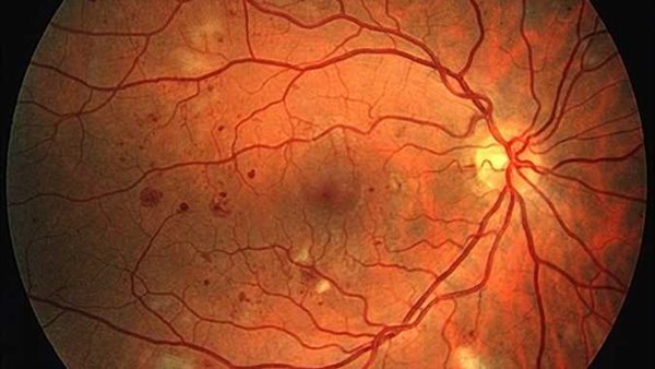 صورة أرشيفية