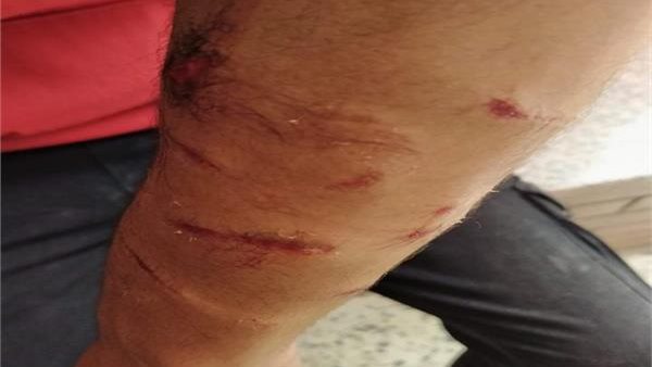 اصابة الطالب