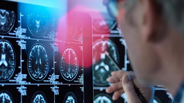 فيروس كورونا يؤثر