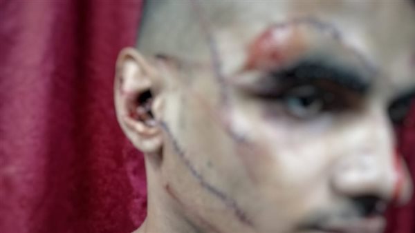 المجني عليه