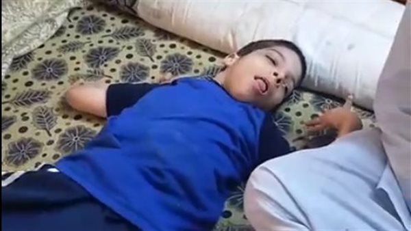 الطفل المصاب 