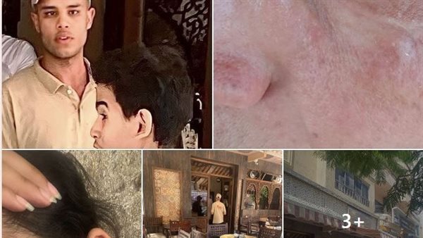 جانب من الواقعة 