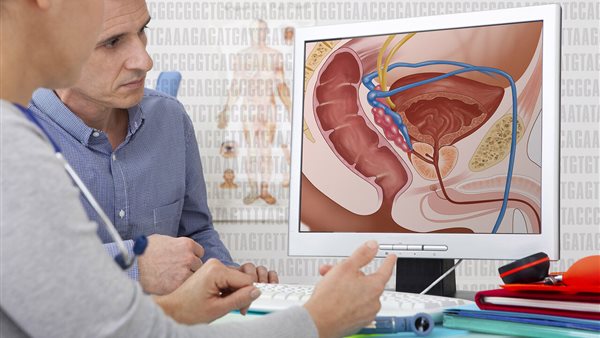 تضخم البروستاتا 