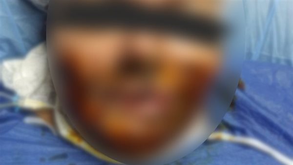 سائق توك توك يشوه