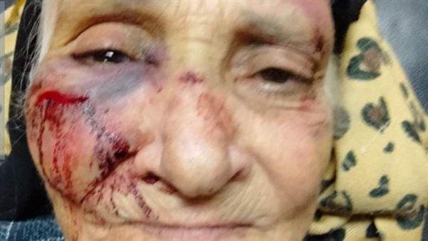 المجني عليها 