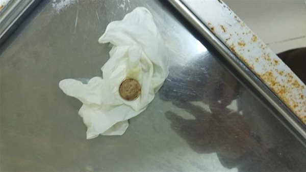 عملة معدنية ابتلعها