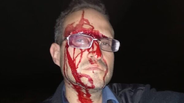 صورة للناشط الاسرائيلي