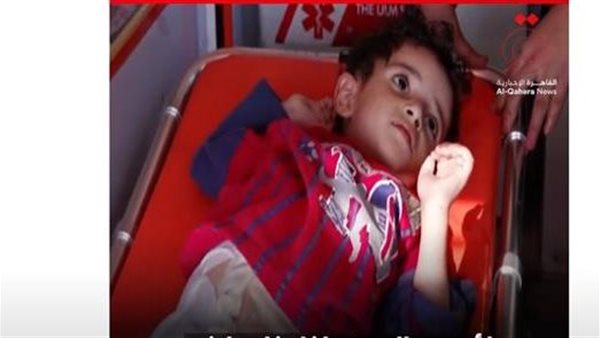 الطفل الفلسطيني لؤي