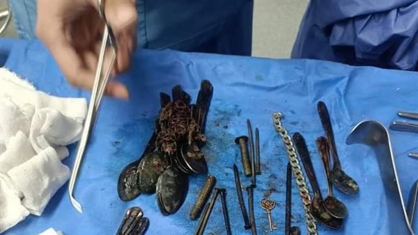 استخراج أجسام معدنية