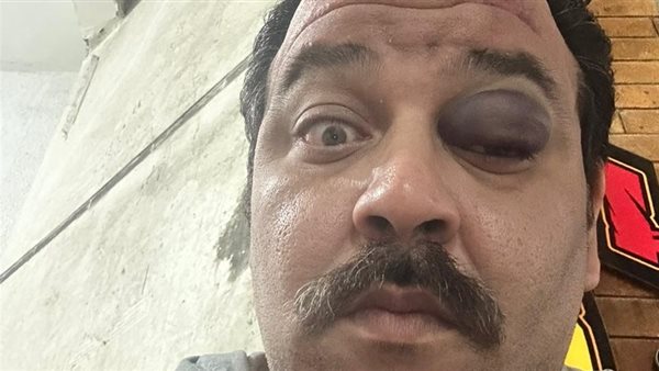 الاعتداء على عصام