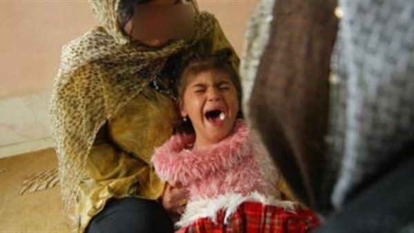 ختان الاناث 