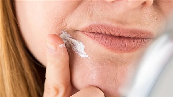 التجاعيد الشفوية