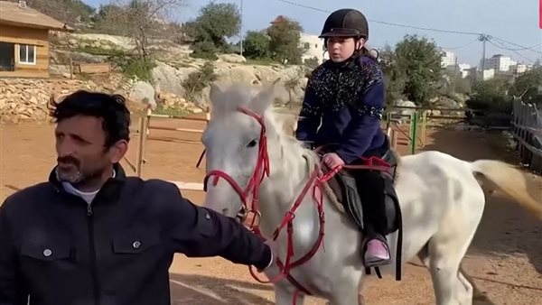 الطفلة المصابة